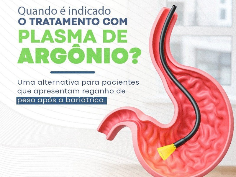 Plasma de Argônio e a Cirurgia Bariátrica